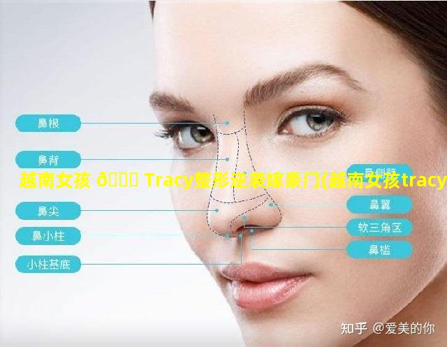 越南女孩 🐛 Tracy整形逆袭嫁豪门(越南女孩tracy整形逆袭嫁豪门)